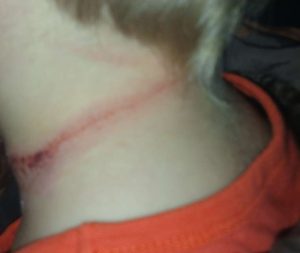 "Рятувала від війни, а ледь не вбили в садочку": у Мюнхені намагалися задушити 4-річного українця